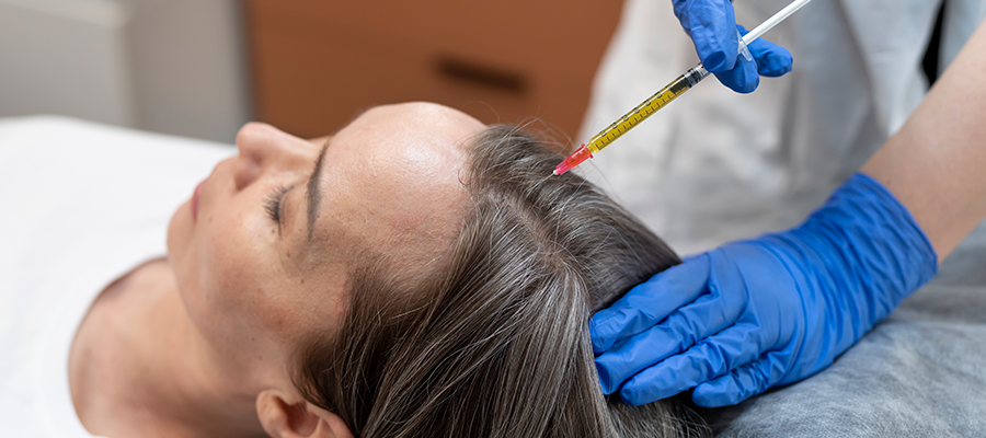 Haartransplantation für Frauen